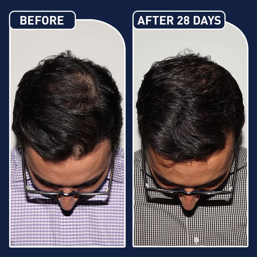 FEG Plus Hair Growth Spray Original-USA