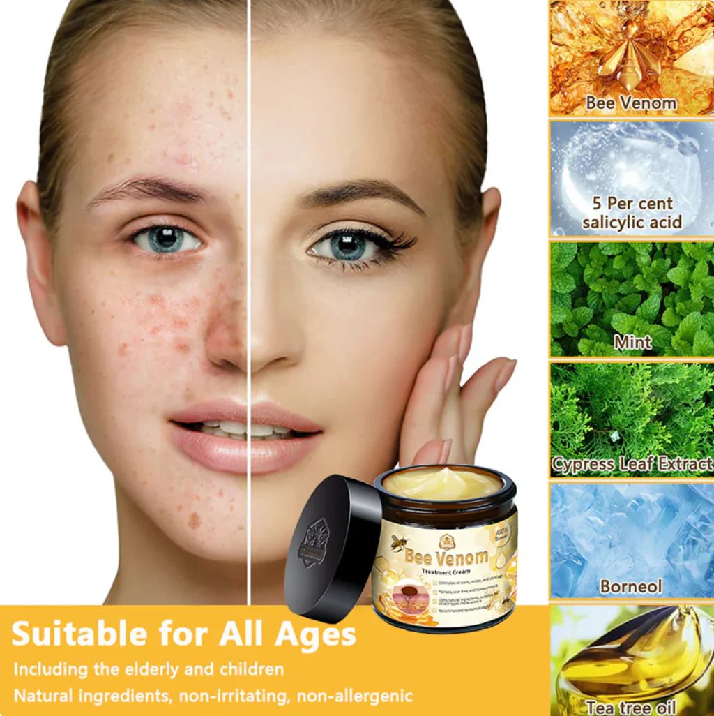 Bee Venam Wart & Mole Removel Cream