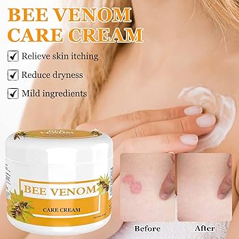 Bee Venam Wart & Mole Removel Cream