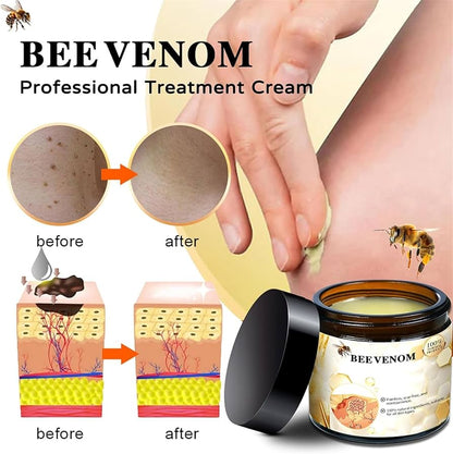 Bee Venam Wart & Mole Removel Cream