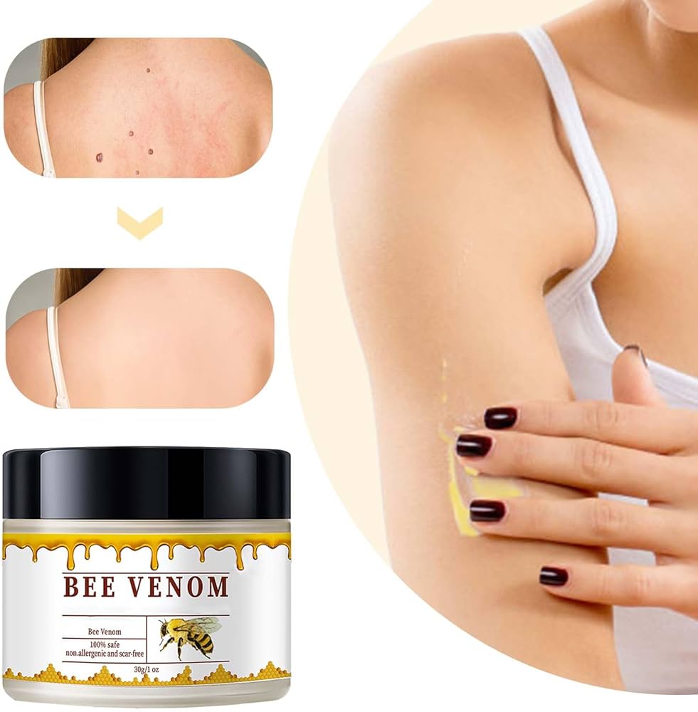 Bee Venam Wart & Mole Removel Cream