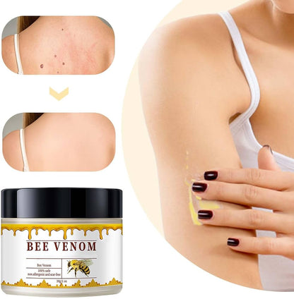 Bee Venam Wart & Mole Removel Cream