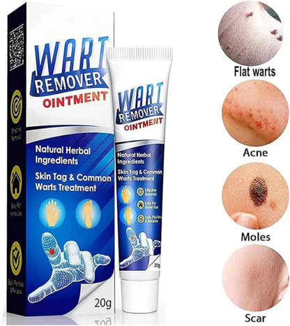 Wart Removal Cream